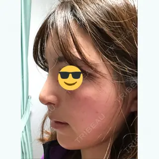 15日目の経過画像（1枚目）