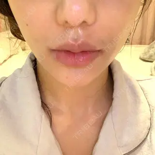 0日目の経過画像（1枚目）