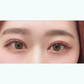 57日目の経過画像（1枚目）