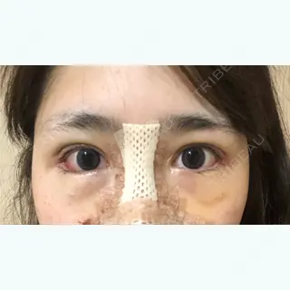 7日目の経過画像（1枚目）