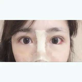 7日目の経過画像（2枚目）