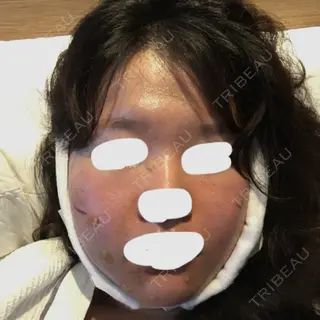 0日目の経過画像（1枚目）
