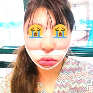 2日目の経過画像（1枚目）