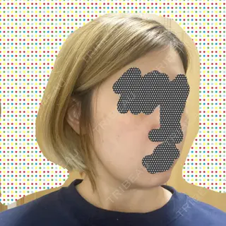 7日目の経過画像（3枚目）