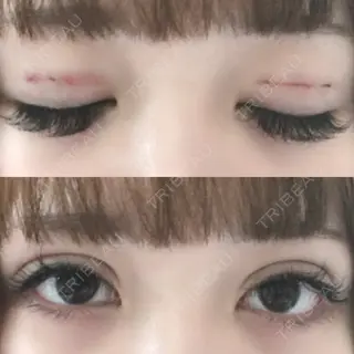 0日目の経過画像（2枚目）