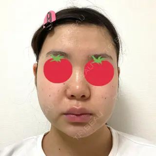 3日目の経過画像（1枚目）