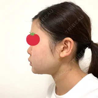 3日目の経過画像（3枚目）