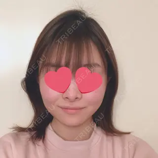 69日目の経過画像（2枚目）