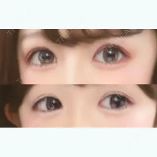 80日目の経過画像（1枚目）