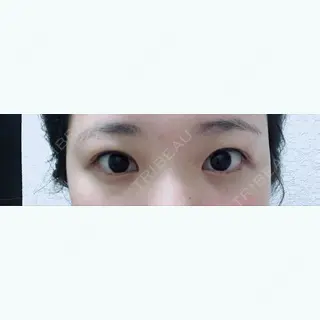 7日目の経過画像（1枚目）