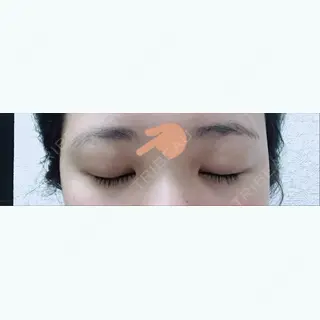 7日目の経過画像（2枚目）