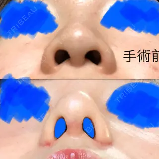 18日目の経過画像（3枚目）