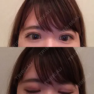 3日目の経過画像（1枚目）