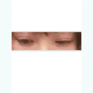 22日目の経過画像（3枚目）