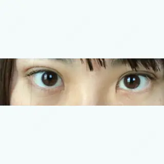 19日目の経過画像（1枚目）