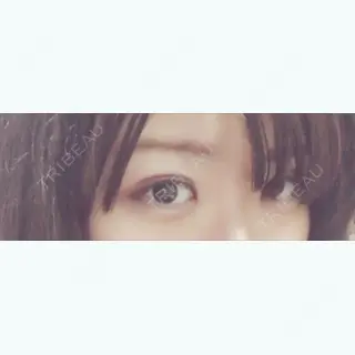 3日目の経過画像（1枚目）