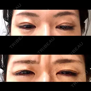 102日目の経過画像（3枚目）