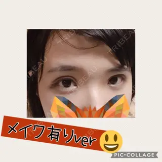 4日目の経過画像（2枚目）