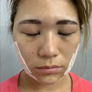 1日目の経過画像（1枚目）