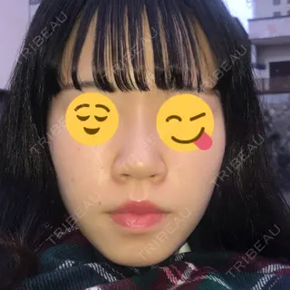 1日目の経過画像（1枚目）