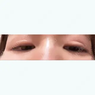 187日目の経過画像（2枚目）
