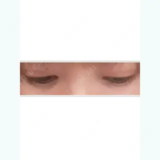 23日目の経過画像（2枚目）