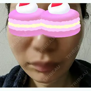 1日目の経過画像（1枚目）
