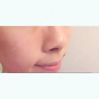 10日目の経過画像（1枚目）