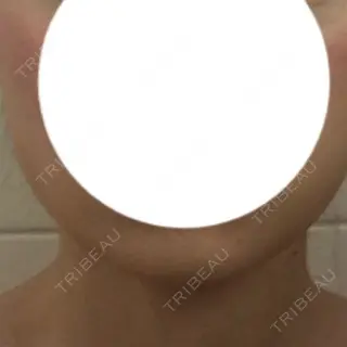 2日目の経過画像（1枚目）