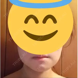 21日目の経過画像（1枚目）