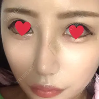 7日目の経過画像（2枚目）
