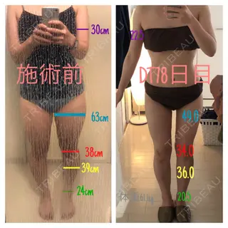 78日目の経過画像（1枚目）