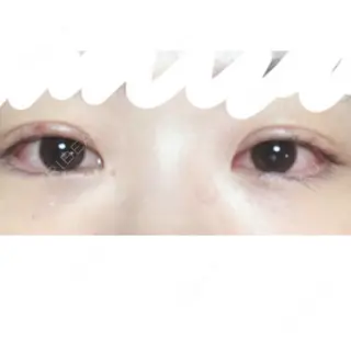 19日目の経過画像（2枚目）