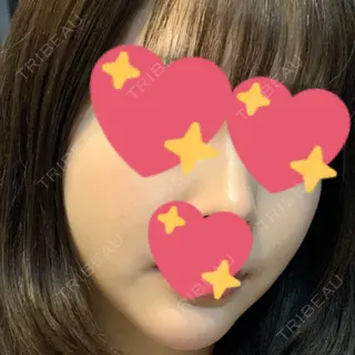 111日目の経過画像（2枚目）