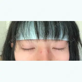 1日目の経過画像（2枚目）
