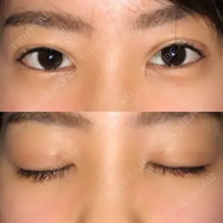 4日目の経過画像（1枚目）