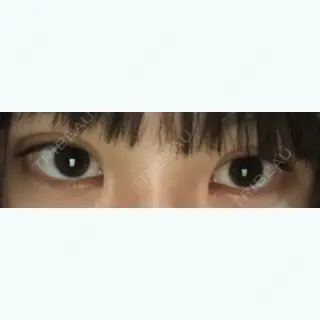 23日目の経過画像（1枚目）