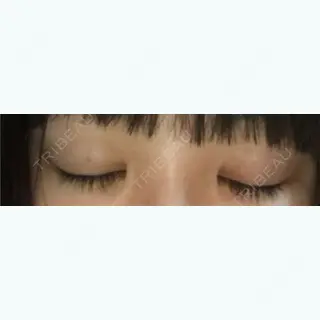 23日目の経過画像（2枚目）