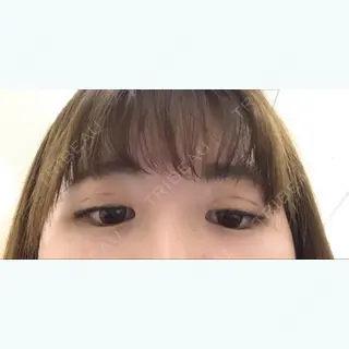 9日目の経過画像（2枚目）