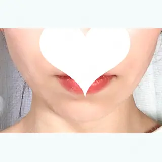 5日目の経過画像（1枚目）