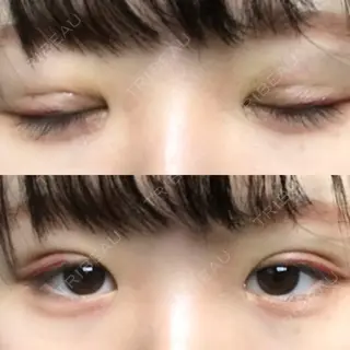 2日目の経過画像（2枚目）