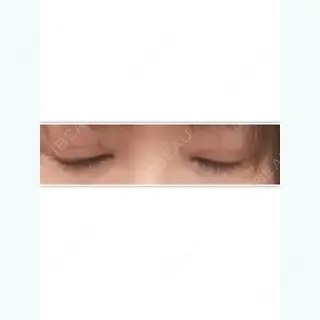 27日目の経過画像（3枚目）