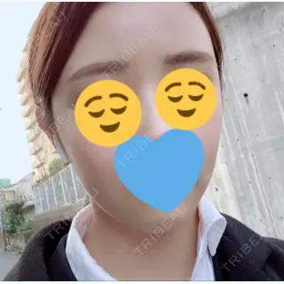 122日目の経過画像（1枚目）