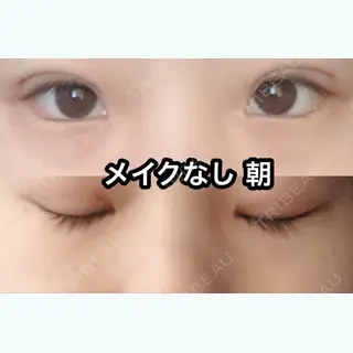 14日目の経過画像（1枚目）