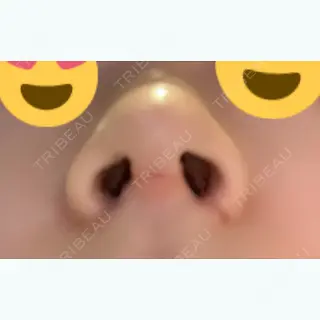 7日目の経過画像（1枚目）