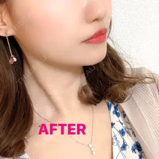 0日目の経過画像（2枚目）