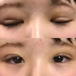 3日目の経過画像（1枚目）