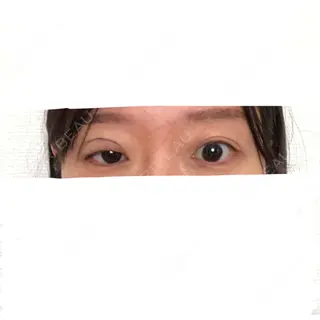 0日目の経過画像（1枚目）