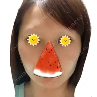 8日目の経過画像（1枚目）