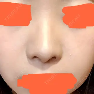 8日目の経過画像（1枚目）